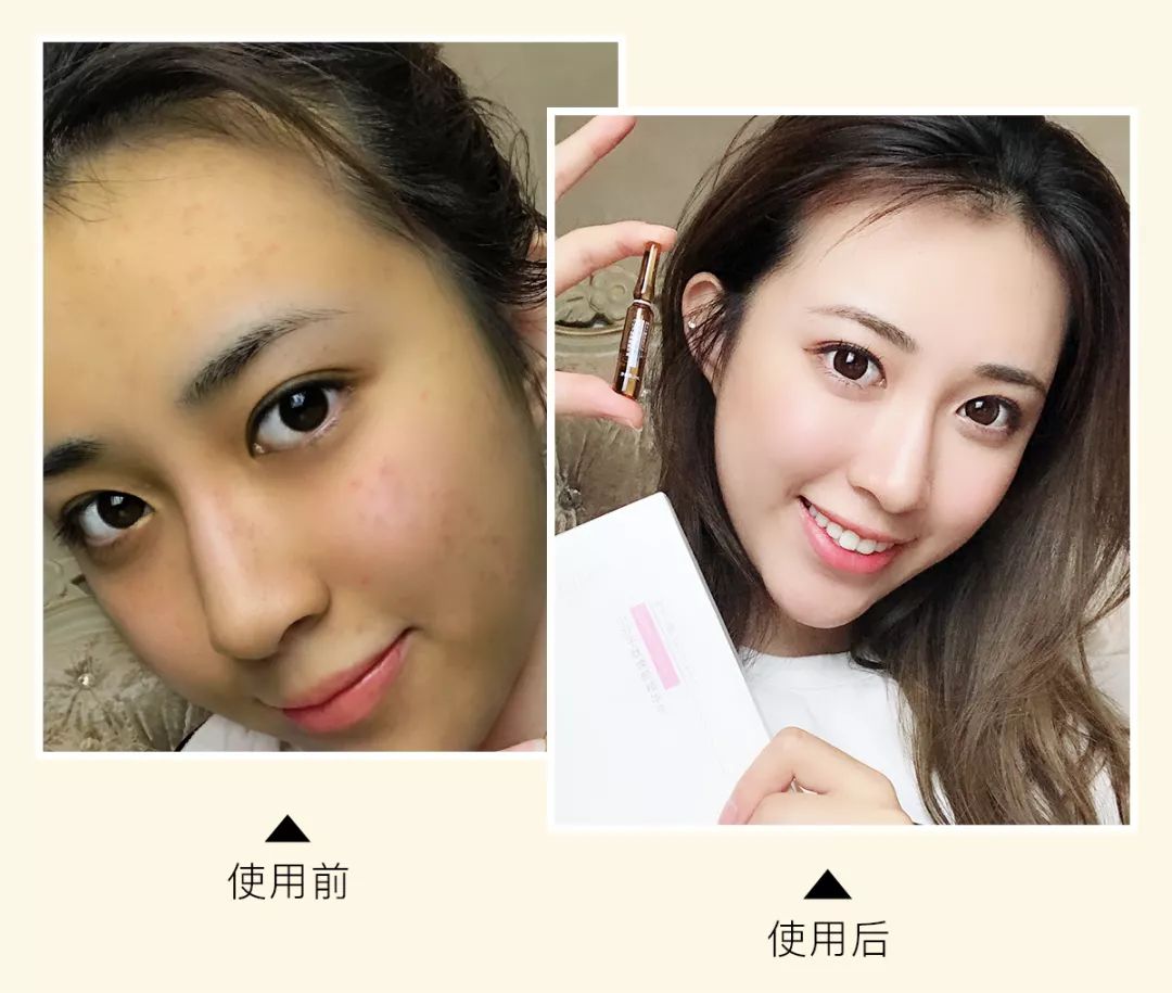 资生堂配方测试,资生堂配方测评