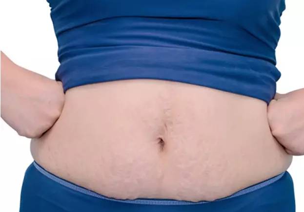 二胎孕期剖腹产刀疤痒怎么回事,二胎孕期剖腹产刀口痒