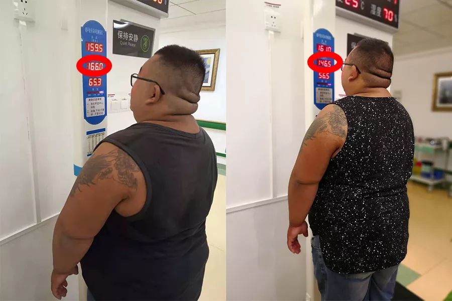 秦鉴教授说禁食和减肥,秦鉴禁食疗法费用