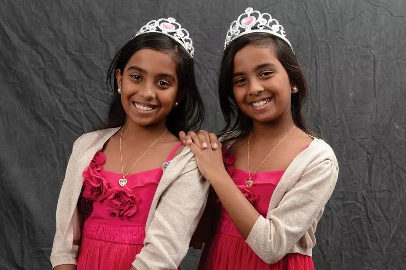 这对要上牛津剑桥的美女姐妹花，16年前是连体婴！存活率仅百万分之一