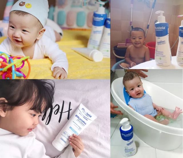 宝宝肌肤换季敏感如何预防,换季宝宝皮肤护理