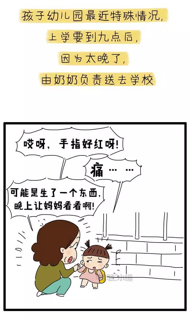 撕倒刺指甲化脓掉了,拔倒刺后指甲脱落