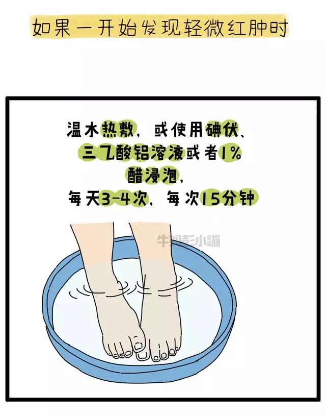 撕倒刺指甲化脓掉了,拔倒刺后指甲脱落