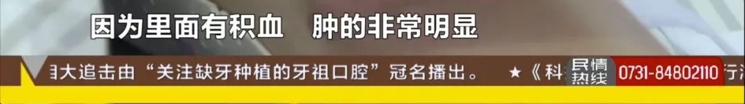初中女生运动会跑步摔倒大哭,中考体育女生跑步摔倒