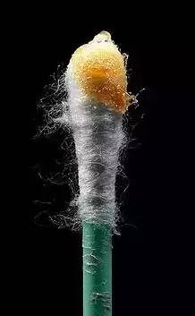 老娘没狐臭！就算有，也是正常！