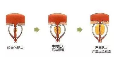 介入科普合集,介入健康科普短视频