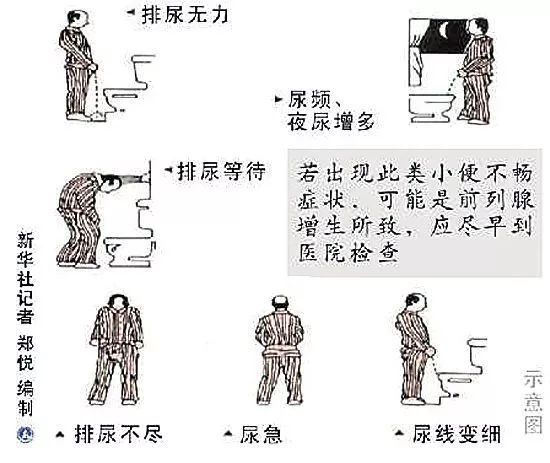 介入科普合集,介入健康科普短视频