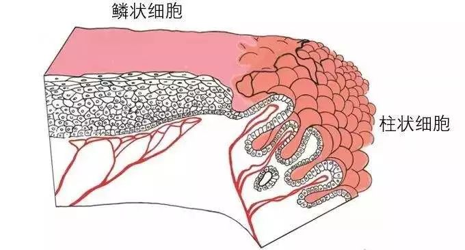 宫颈糜烂到底要不要做激光手术,宫颈糜烂到底要不要做手术