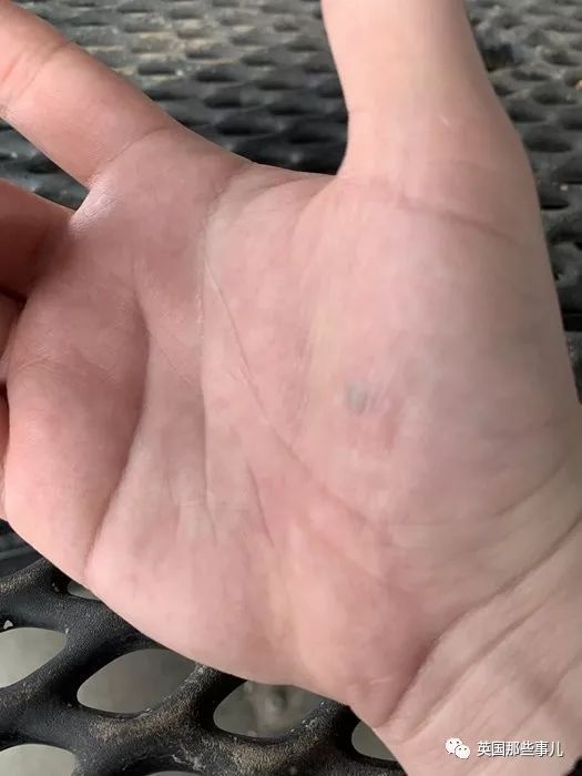 熊孩子拿铅笔扎同学,是不是每个中国小孩都被铅笔扎过