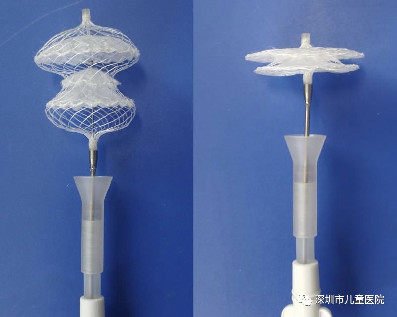 全球首款！深儿医参与研发这把“伞”，“补心”不留痕迹