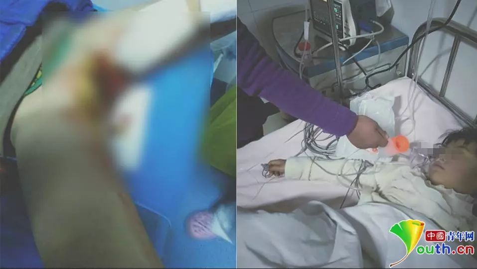 甘肃8岁女生被打致*体下**出血！官方：两名男同学用笤帚把所伤，涉事校长免职