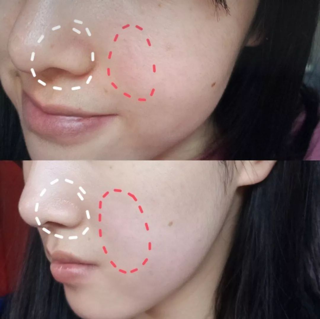 补水保湿滋润肌肤面膜10片装一盒,安瓶精华水润透亮睡眠面膜