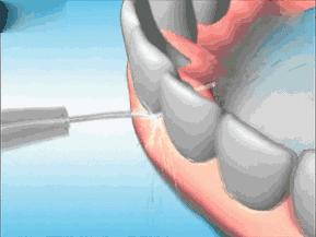 推广｜身份证42开头的关注！牙齿矫正、种植牙，这些全免费！