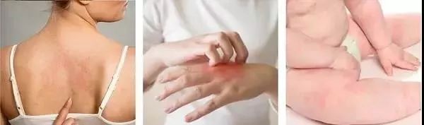 团购返场｜皮衣发霉、真丝变黄，除湿器帮你救活几万块的衣裳