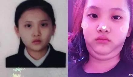 连续熬夜长出毛尾巴,20岁大学生连续熬夜长出毛尾巴