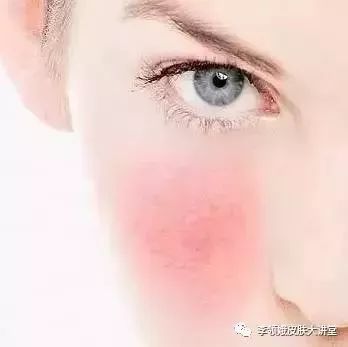 杏林微科普是什么意思,杏林微科普如何科学预防h7n9