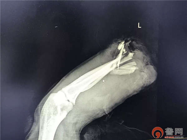 青岛郭先生,青岛即墨明亮手足外科医院