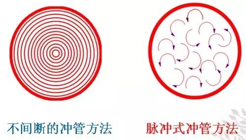 基护｜静脉导管堵塞？如何防堵管？