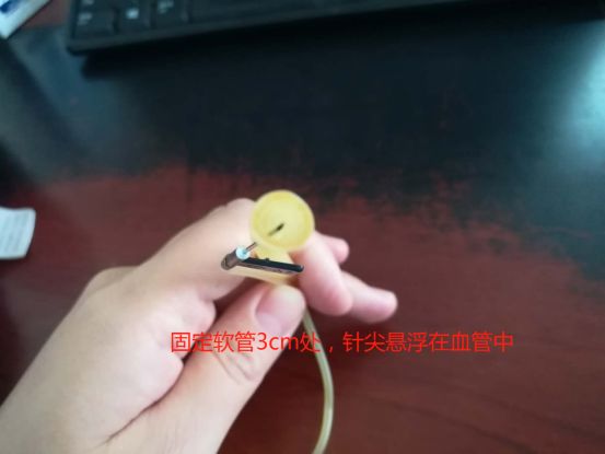 刺血后刺血地方胀痛是什么原因,刺血疗法出不来血是什么原因