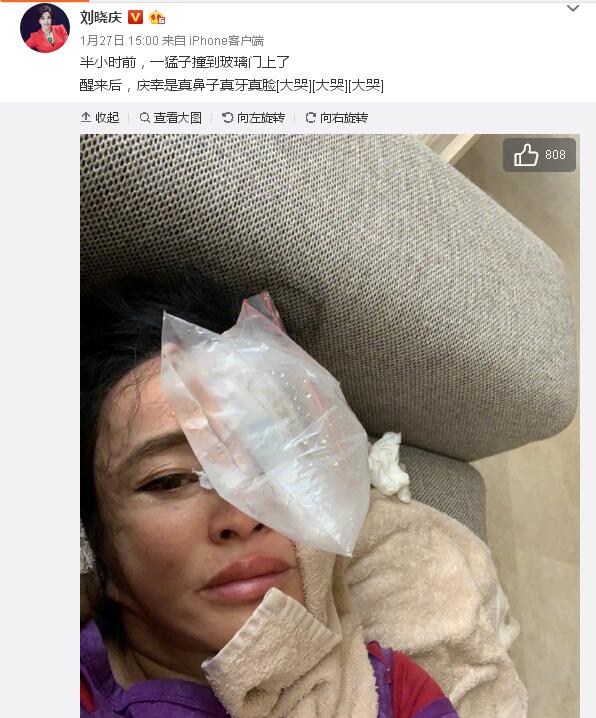 65岁刘晓庆晒少女自拍照片,刘晓庆撞玻璃门新闻