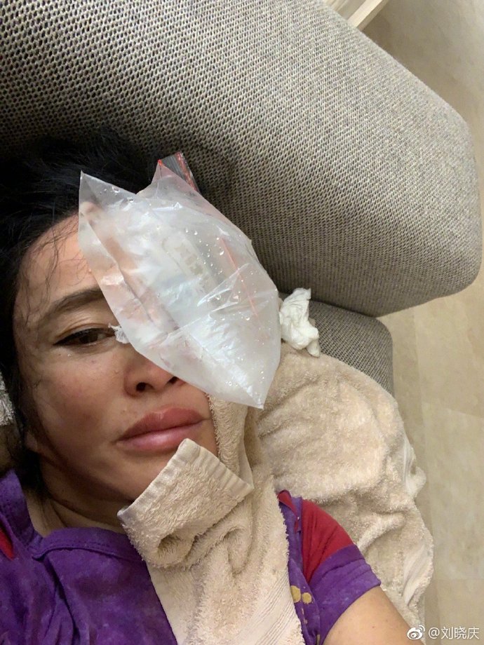 65岁刘晓庆晒少女自拍照片,刘晓庆撞玻璃门新闻