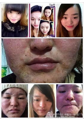 深扒张庭夫妇微商帝国：年缴税21亿，徐峥夫妇站台，产品曾致用户“烂脸”