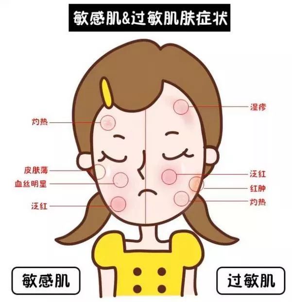 皮肤敏感泛红发痒什么原因,敏感肌皮肤泛红皮肤紧绷