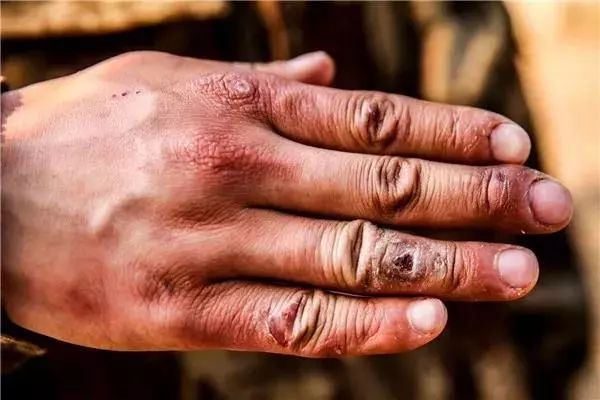 关注退役军人了解更多知识,关注军人