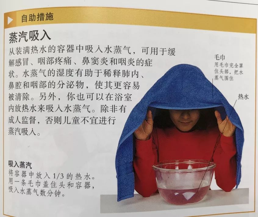 孩子感冒流黄绿色的鼻涕，是鼻窦炎吗？需要用抗生素吗？什么时候需要用抗生素？