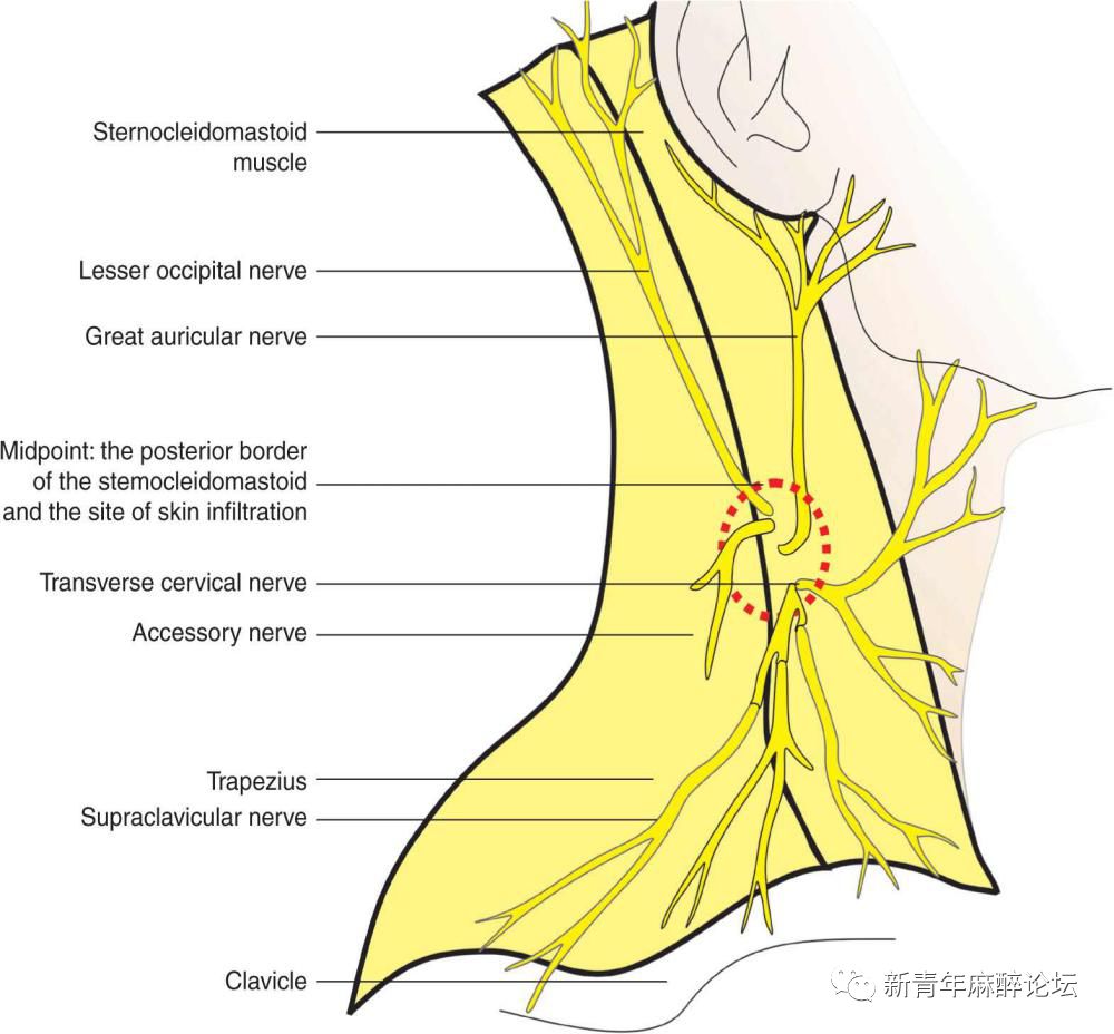 落枕了怎么办最快最有效方法,落枕了怎么办按什么穴位