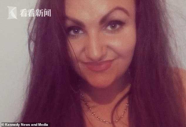 18岁女子染发剂过敏脸肿大一倍像“怪物”眼睛两天睁不开