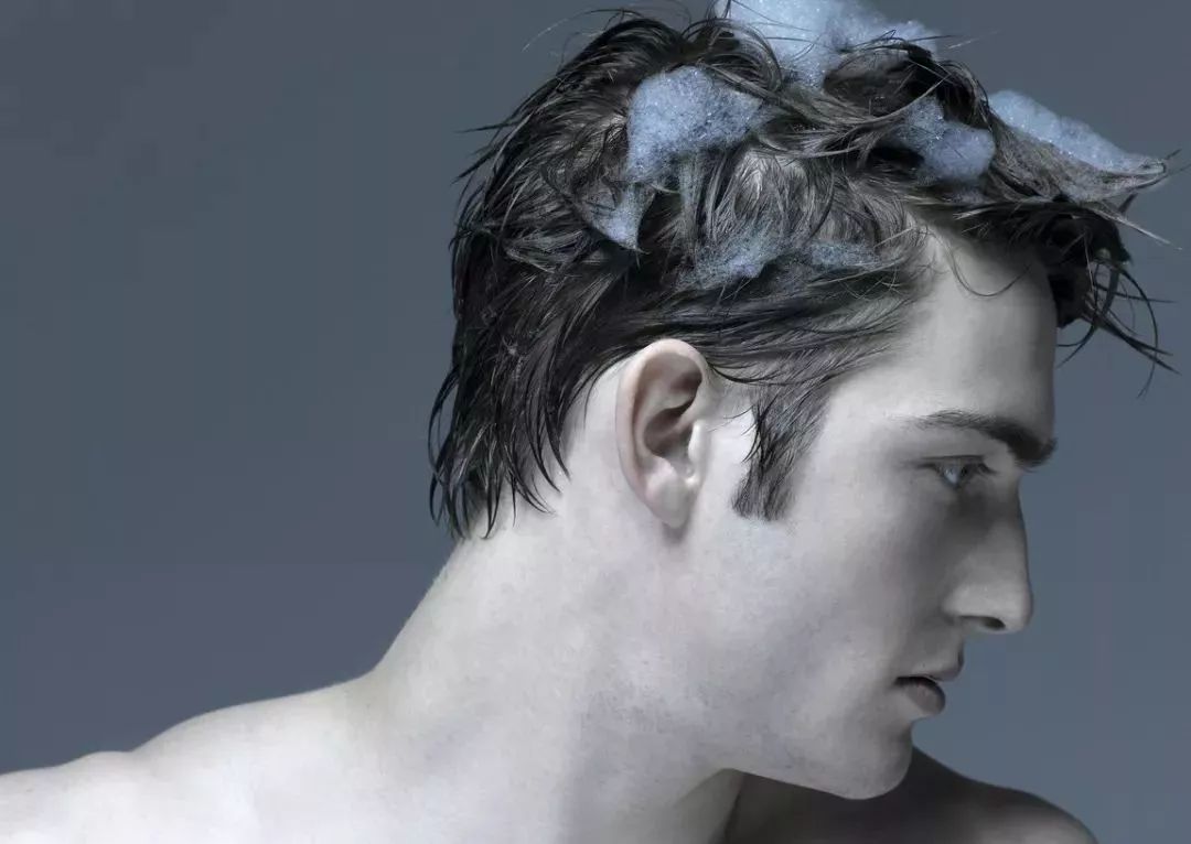 头皮屑是我最大的烦恼,你真正了解头皮屑吗