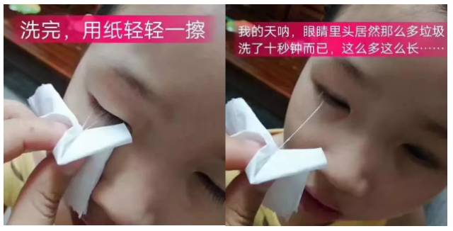 景甜眼部护理,景甜推荐洗眼