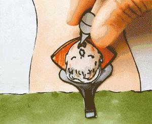 如何选择剖宫产还是顺产,顺产还是剖宫产到底怎么选