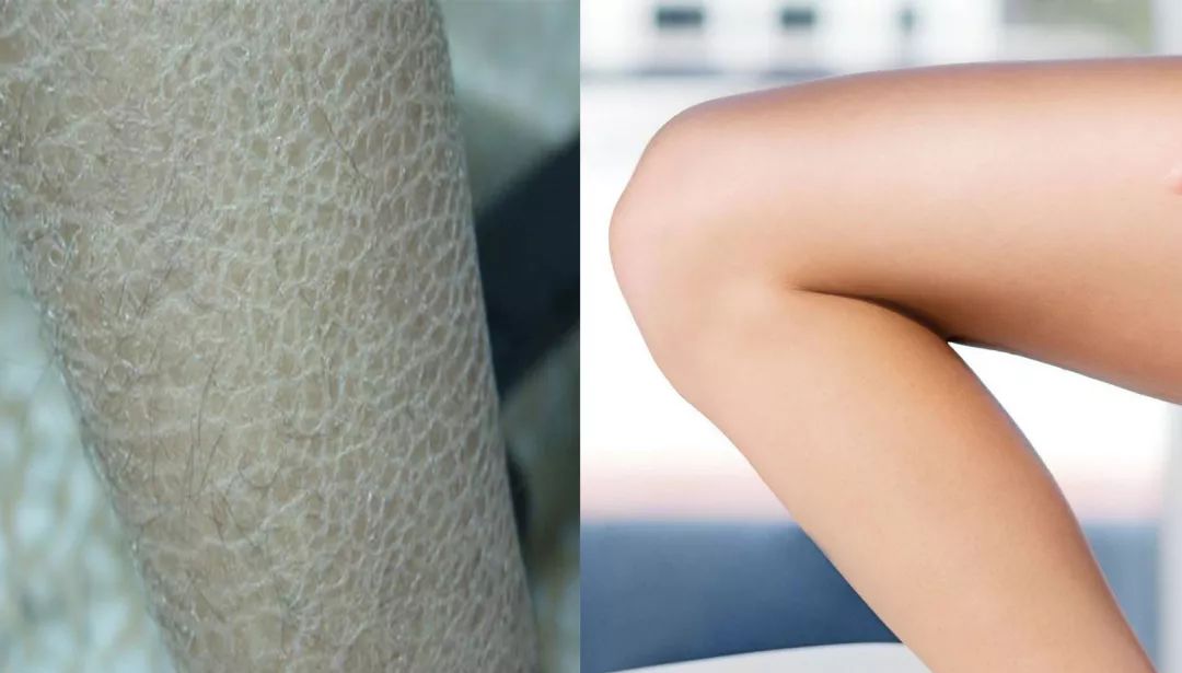 超强瘦腿袜压力袜春秋,打底瘦腿袜冬