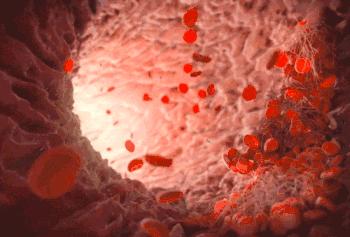 洗血净化,血液净化揭秘