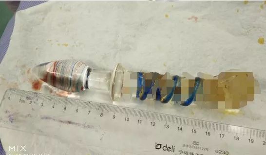 男子肛门塞进三条泥鳅，知道原因医生要哭了…