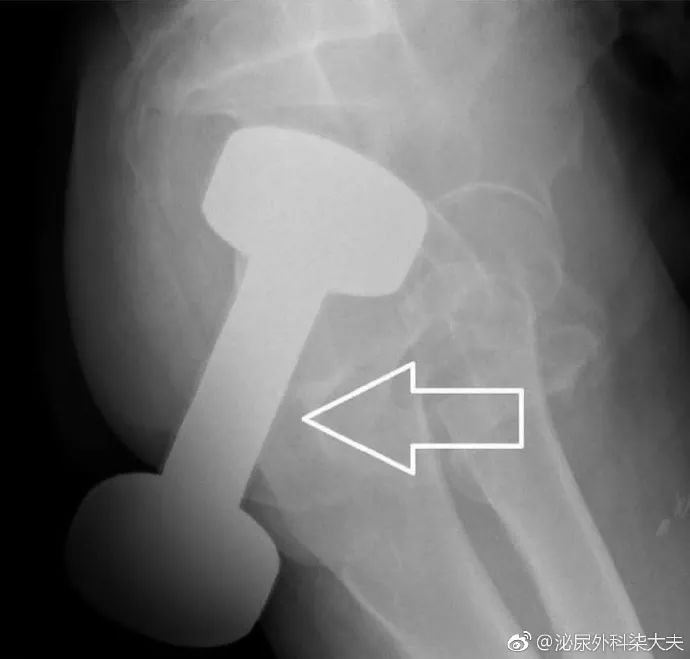 男子肛门塞进三条泥鳅，知道原因医生要哭了…