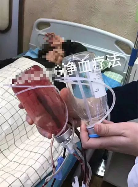 “洗血”疗法是什么鬼？减肥排毒还改善皮肤？这种医美太可怕……