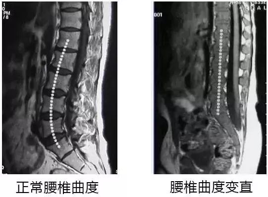 情人节福利礼包,情人节福利秒杀