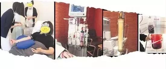 “洗血”疗法是什么鬼？减肥排毒还改善皮肤？这种医美太可怕……