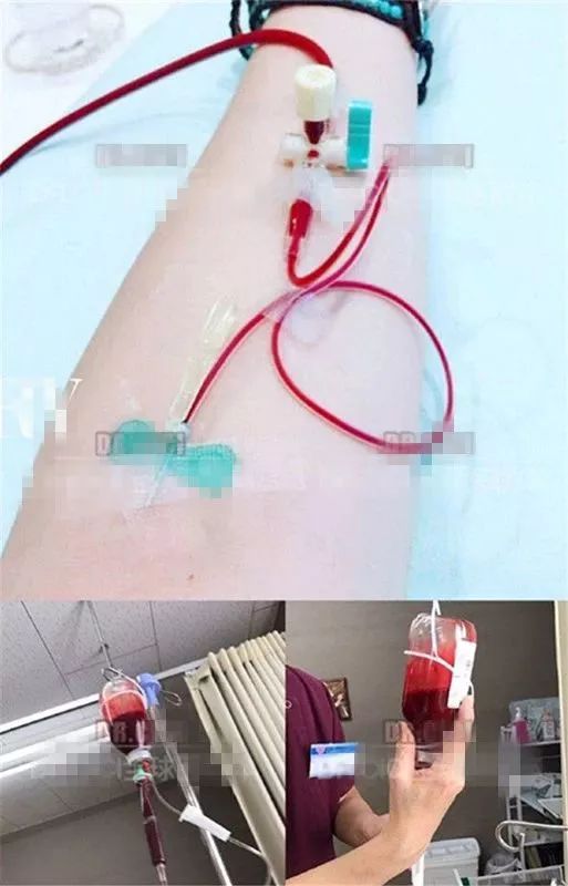 深扒那些爆火的网红减肥法,网红最有效果的减肥方法