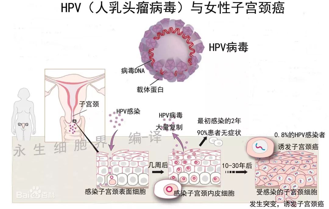 感染hpv不容易怀孕吗,感染hpv没有特效药会传染给小孩吗