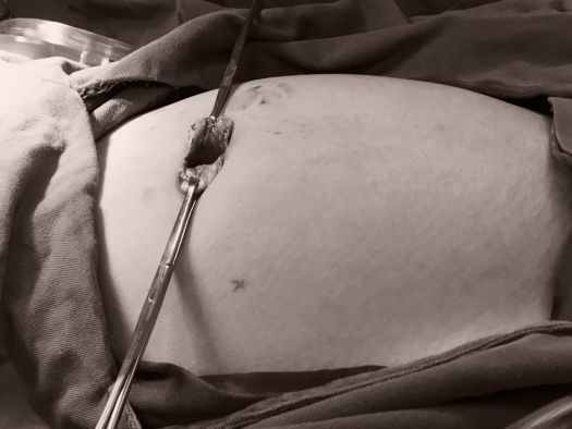 【义诊】有你才有我们，关注女性健康