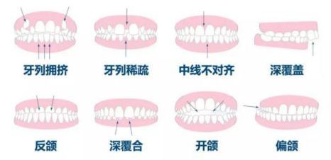 急急急！全城寻找缺牙、难看牙市民，每人最高获助20000元！