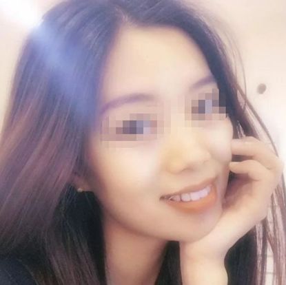 急急急！全城寻找缺牙、难看牙市民，每人最高获助20000元！