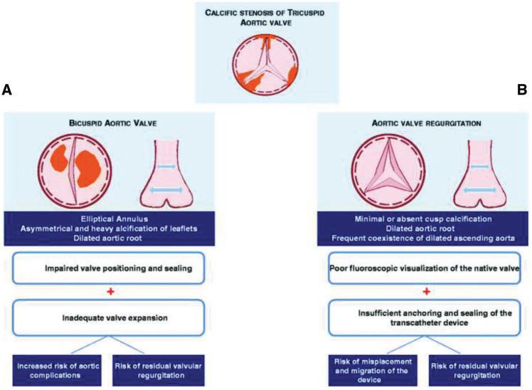 经导管瓣膜修复术费用,经导管介入治疗先天性心脏病