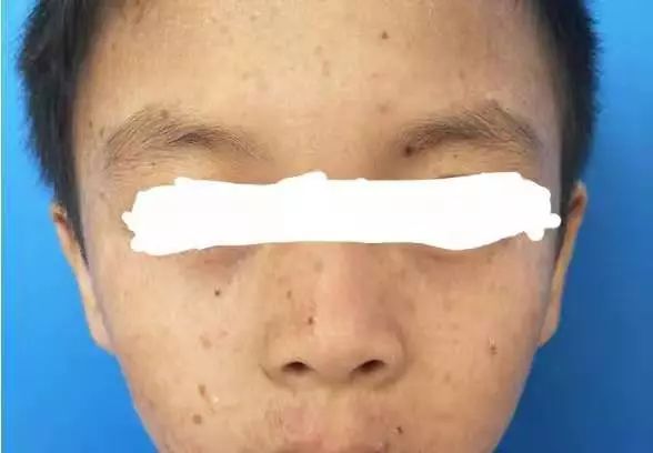 罕见病人自述经历,一个外科医生的自述