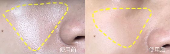 张嘉倪同款月光宝盒精华液,张嘉倪给人涂保湿美白精华液