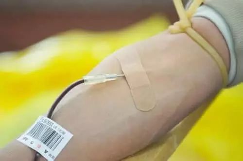献血后有淤青怎么回事,献血后手臂上大面积出现淤青